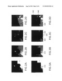 SYSTEM AND METHOD FOR COMPUTER AIDED POLYP DETECTION diagram and image