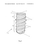 DENTAL IMPLANT diagram and image