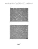 OPTIMIZED AND DEFINED METHOD FOR ISOLATION AND PRESERVATION OF PRECURSOR CELLS FROM HUMAN UMBILICAL CORD diagram and image