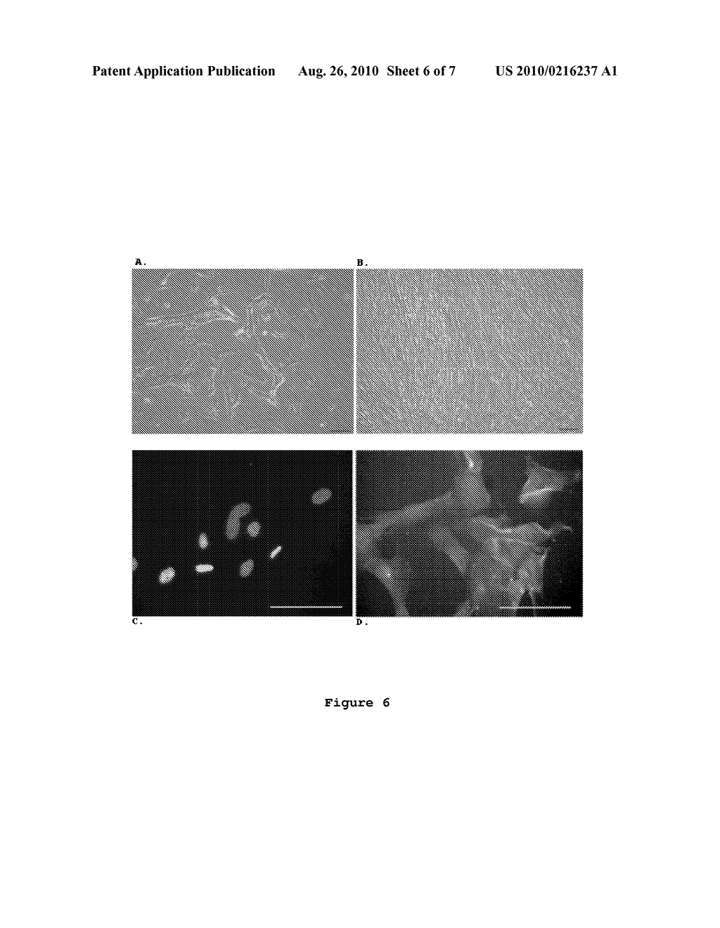 OPTIMIZED AND DEFINED METHOD FOR ISOLATION AND PRESERVATION OF PRECURSOR CELLS FROM HUMAN UMBILICAL CORD - diagram, schematic, and image 07