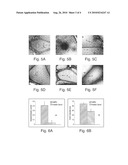 Identification of Biomarkers for Screening and Monitoring of Prostate Cancer and Prostate Related Diseases diagram and image