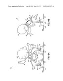 MOTORIZED DOLL diagram and image