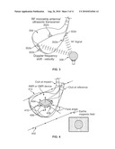 SYSTEM FOR DETERMINING PERFORMANCE CHARACTERISTICS OF A GOLF SWING diagram and image