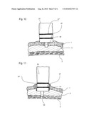 ELECTROSURGICAL INSTRUMENT, AND AN ENDOSCOPE WITH A CORRESPONDING INSTRUMENT diagram and image