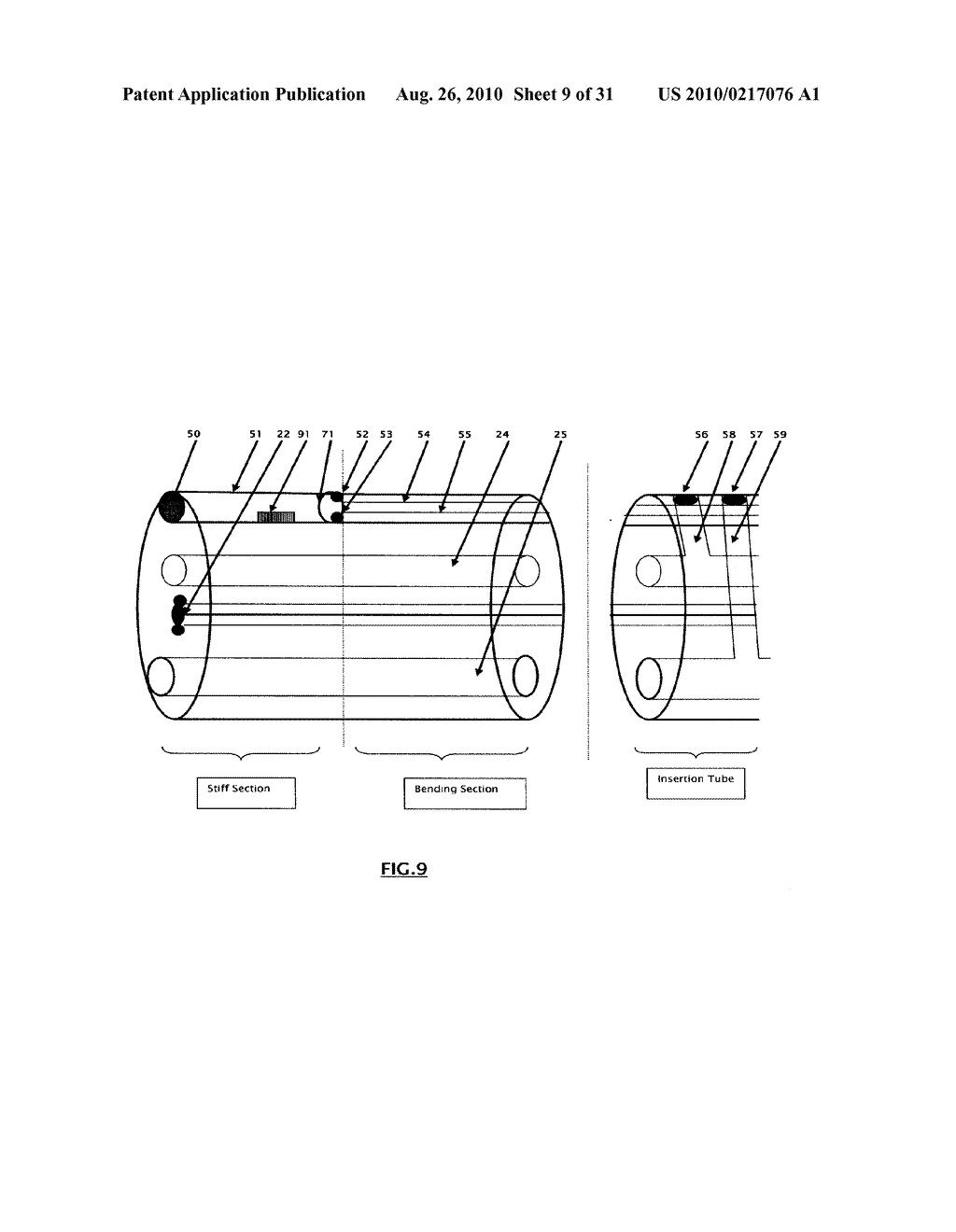 DUAL VIEW ENDOSCOPE - diagram, schematic, and image 10