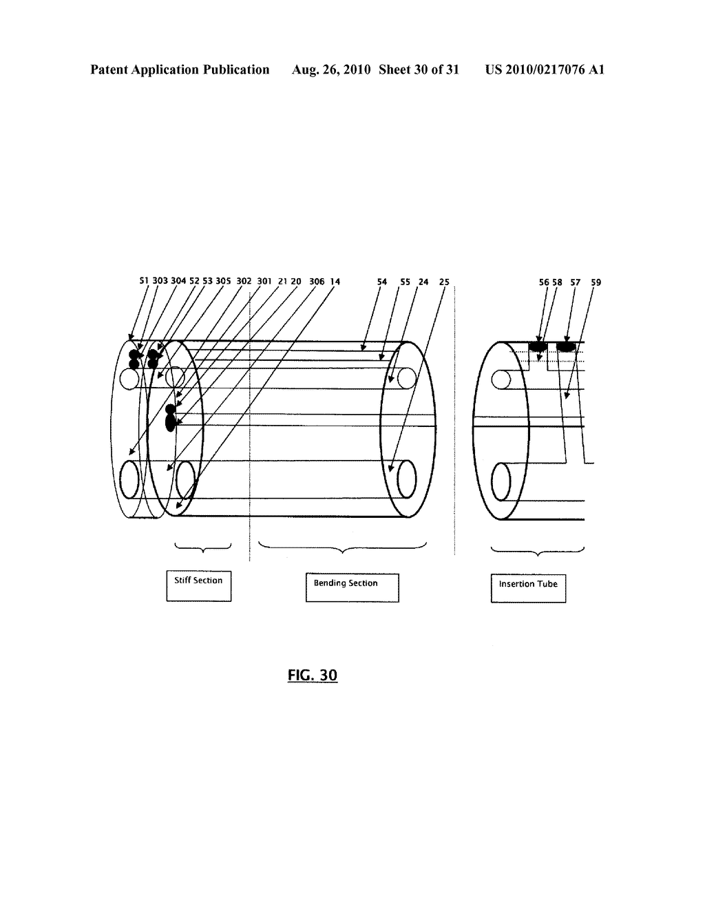 DUAL VIEW ENDOSCOPE - diagram, schematic, and image 31