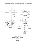 Retractor and mounting pad diagram and image