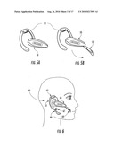 Methods and Apparatus for Assessing Physiological Conditions diagram and image