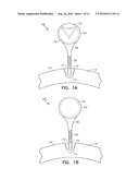 Fiducial Marker Devices, Tools, and Methods diagram and image