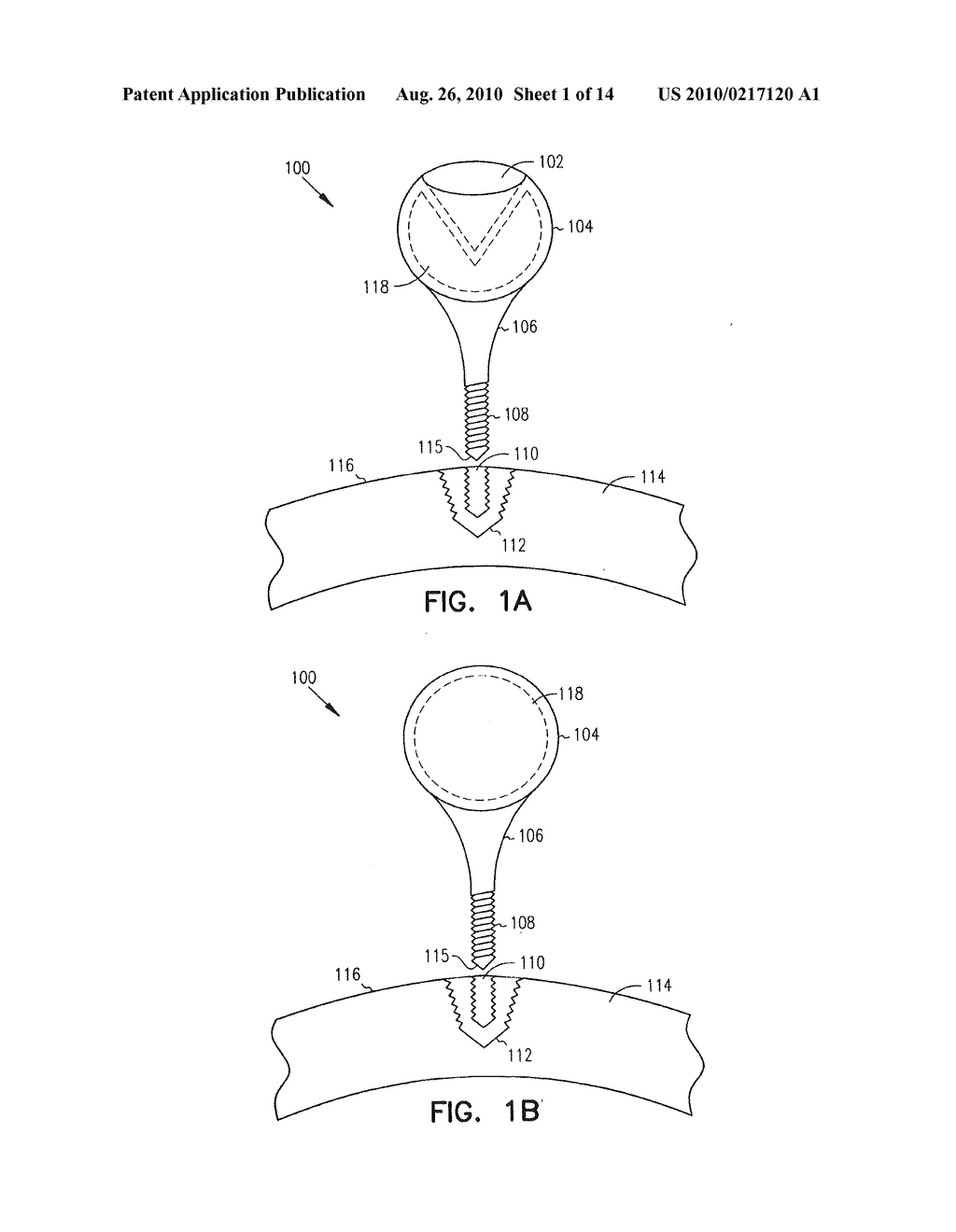 Fiducial Marker Devices, Tools, and Methods - diagram, schematic, and image 02