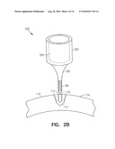 Fiducial Marker Devices, Tools, and Methods diagram and image