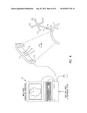 Fiducial Marker Devices, Tools, and Methods diagram and image