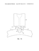 Fiducial Marker Devices, Tools, and Methods diagram and image