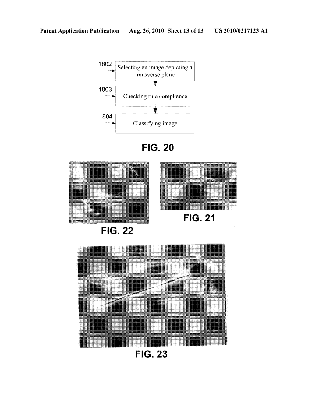 METHODS AND SYSTEMS OF MANAGING ULTRASONOGRAPHIC DIAGNOSIS - diagram, schematic, and image 14