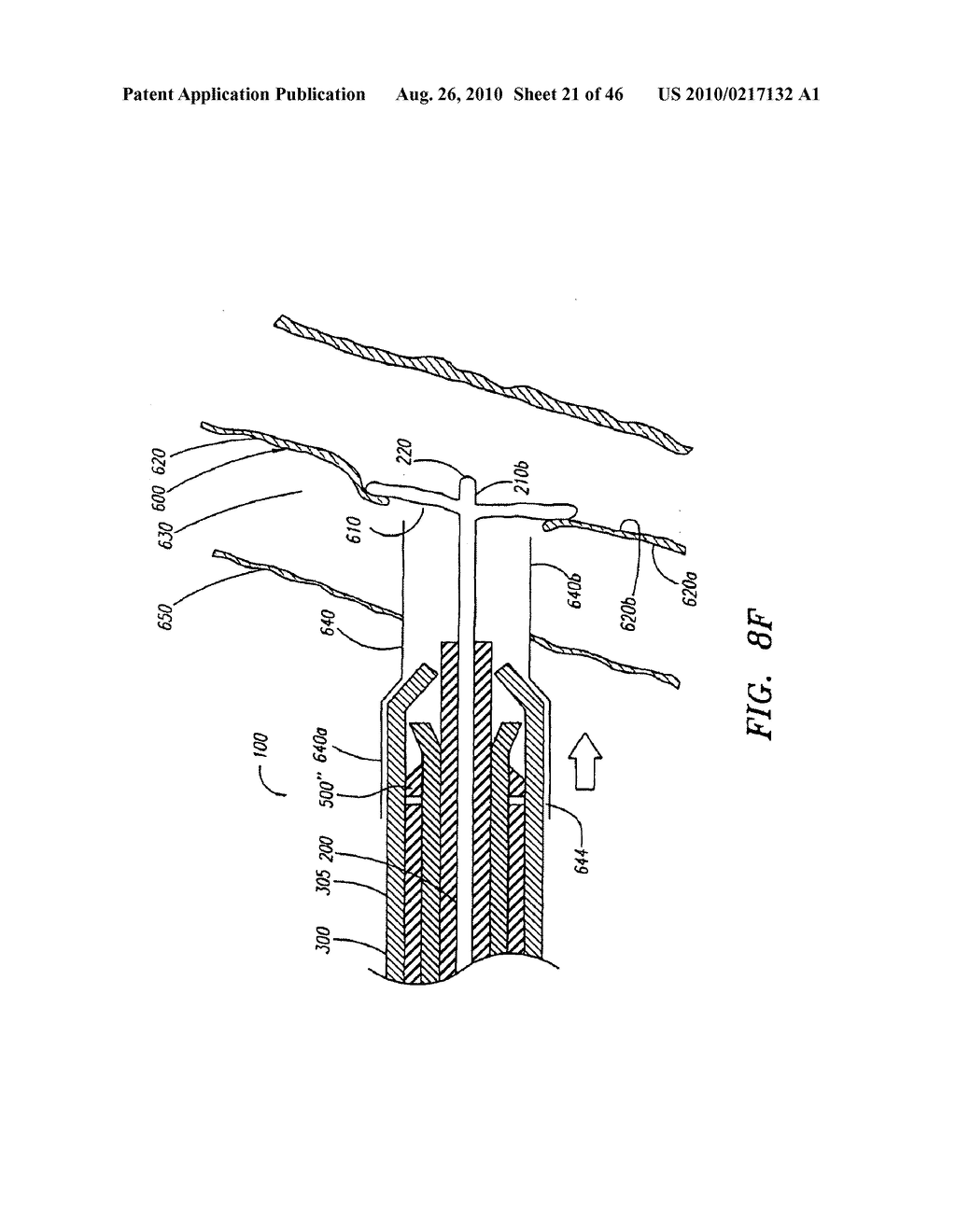 METHODS AND APPARATUS FOR LOCATING A SURFACE OF A BODY LUMEN - diagram, schematic, and image 22