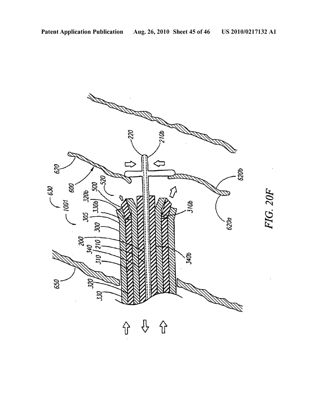 METHODS AND APPARATUS FOR LOCATING A SURFACE OF A BODY LUMEN - diagram, schematic, and image 46