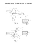 SENSING FORCE DURING PARTIAL AND TOTAL KNEE REPLACEMENT SURGERY diagram and image