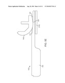 SENSING FORCE DURING PARTIAL AND TOTAL KNEE REPLACEMENT SURGERY diagram and image