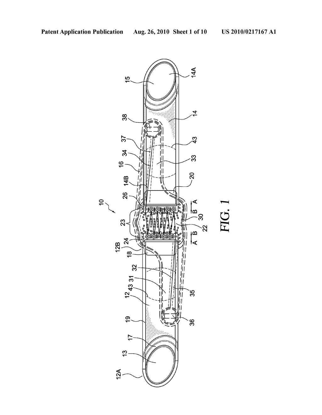 ORTHOPEDIC DEVICE FOR TREATMENT OF THE BACK - diagram, schematic, and image 02