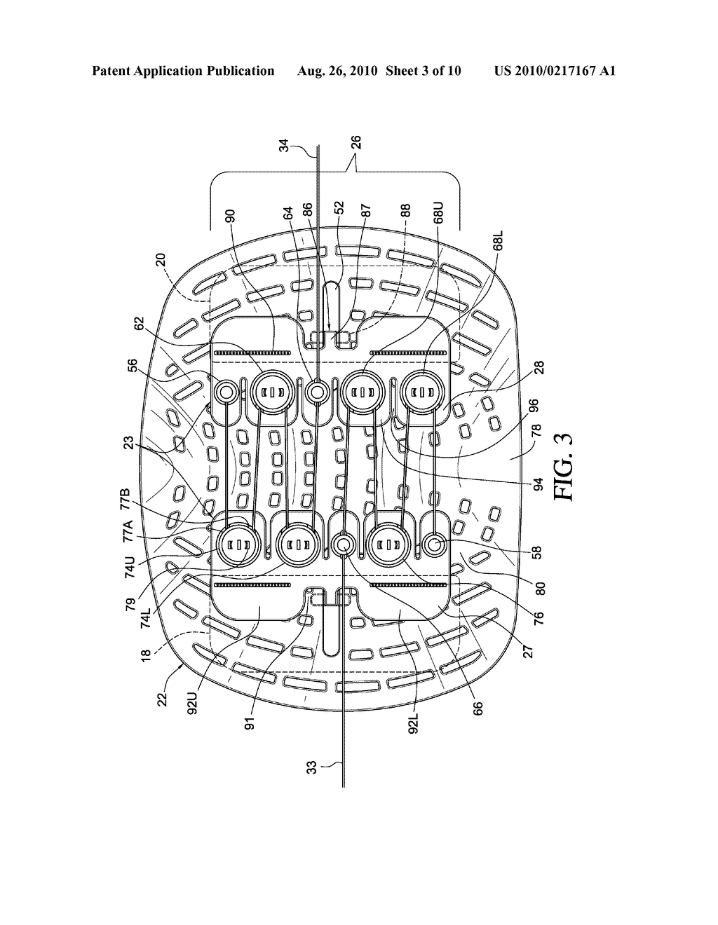 ORTHOPEDIC DEVICE FOR TREATMENT OF THE BACK - diagram, schematic, and image 04