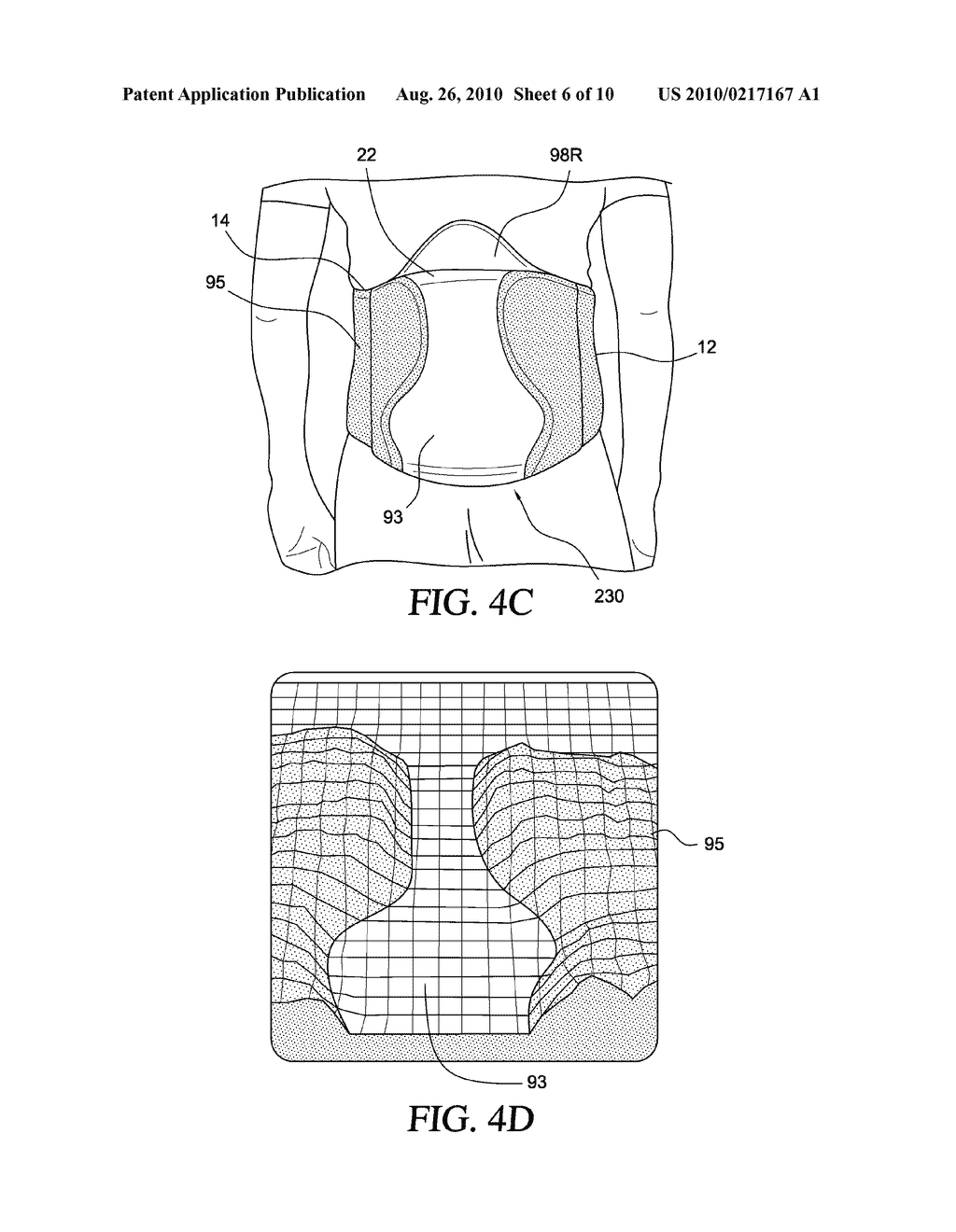 ORTHOPEDIC DEVICE FOR TREATMENT OF THE BACK - diagram, schematic, and image 07