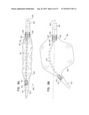 CATHETER INCLUDING A BENDABLE PORTION diagram and image