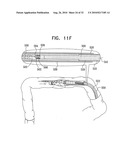 CATHETER INCLUDING A BENDABLE PORTION diagram and image