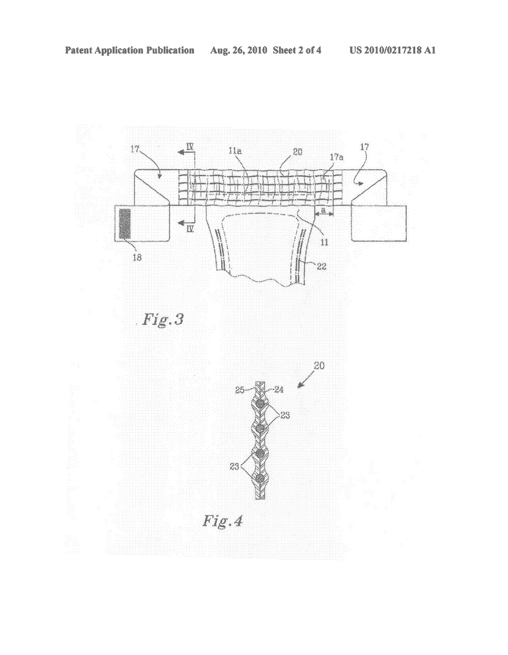 BELTED ABSORBENT GARMENT - diagram, schematic, and image 03