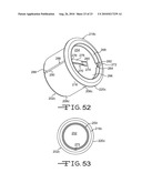 PARTIALLY IMPLANTABLE MEDICAL DEVICES AND METHODS diagram and image
