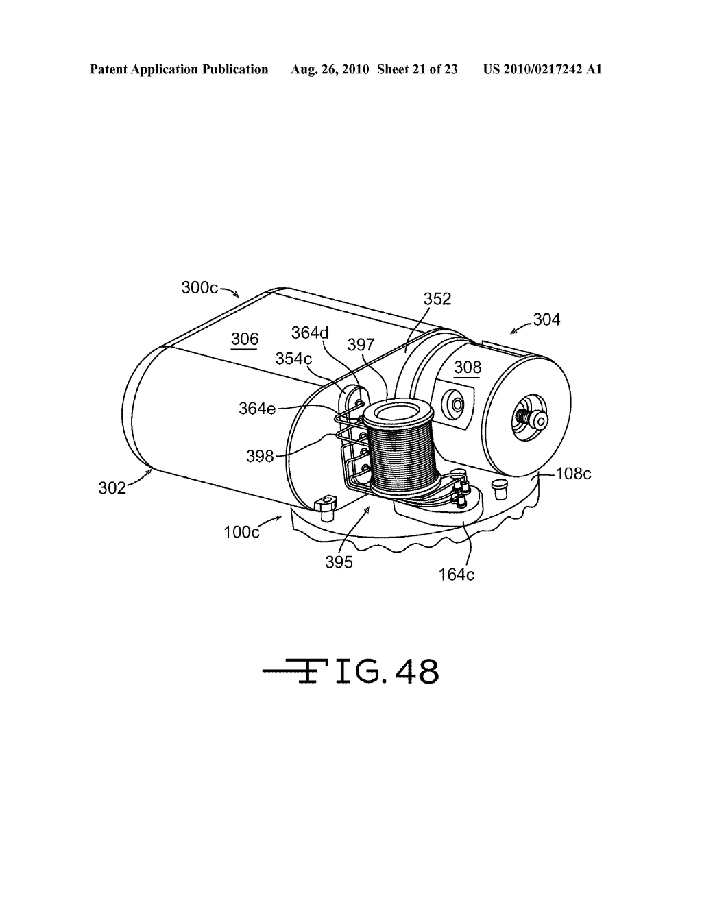 PARTIALLY IMPLANTABLE MEDICAL DEVICES AND DELIVERY/MANIFOLD TUBE FOR USE WITH SAME - diagram, schematic, and image 22