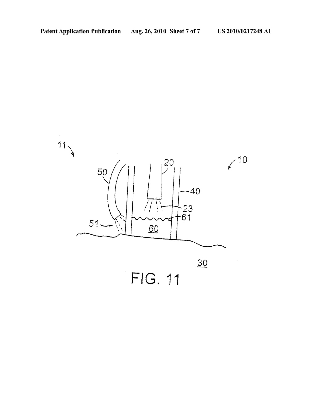 Methods And Systems For Laser Treatment Using Non-Uniform Output Beam - diagram, schematic, and image 08