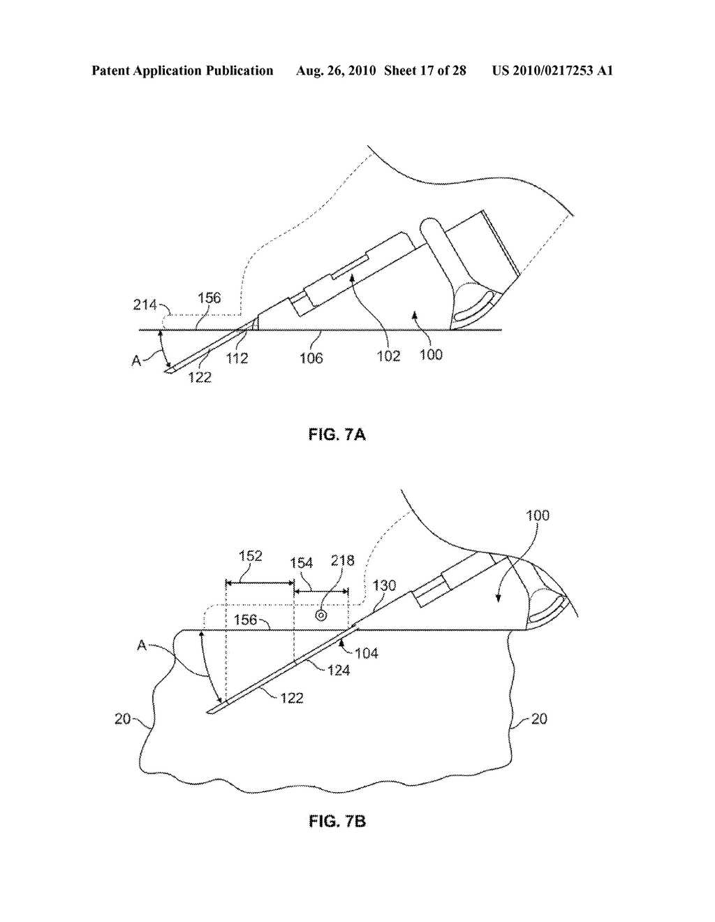 DEVICES AND METHODS FOR PERCUTANEOUS ENERGY DELIVERY - diagram, schematic, and image 18