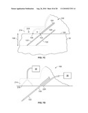 DEVICES AND METHODS FOR PERCUTANEOUS ENERGY DELIVERY diagram and image