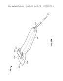 DEVICES AND METHODS FOR PERCUTANEOUS ENERGY DELIVERY diagram and image