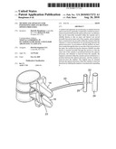 Method and apparatus for positioning implant between spinous processes diagram and image