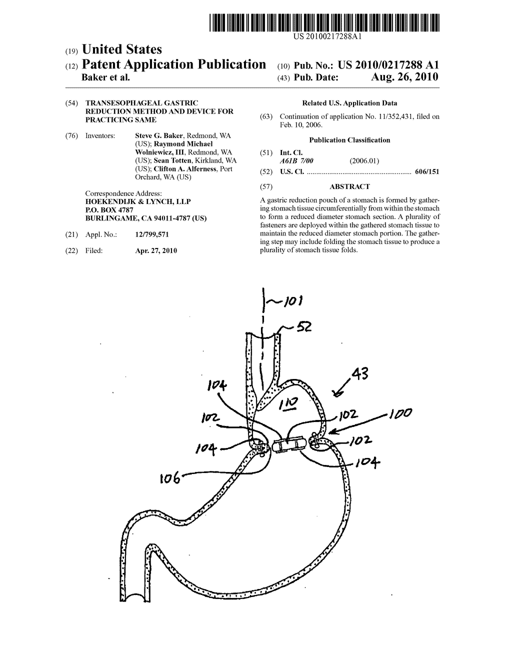 Transesophageal gastric reduction method and device for practicing same - diagram, schematic, and image 01