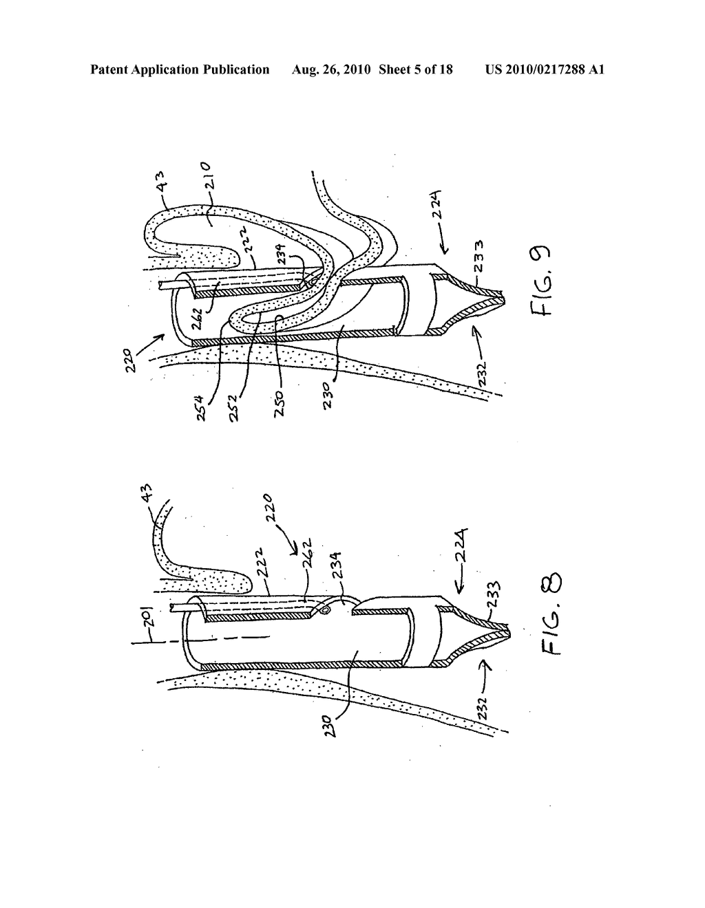 Transesophageal gastric reduction method and device for practicing same - diagram, schematic, and image 06