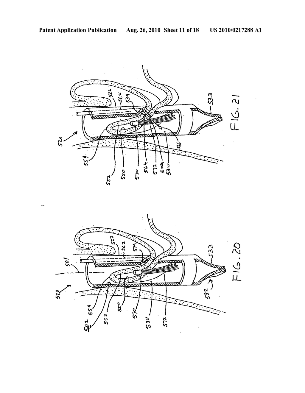 Transesophageal gastric reduction method and device for practicing same - diagram, schematic, and image 12