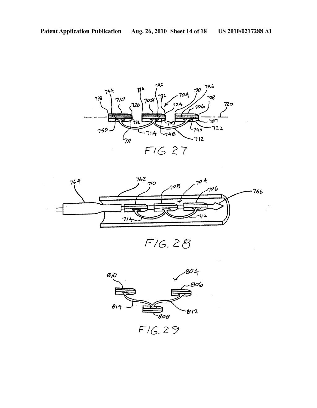 Transesophageal gastric reduction method and device for practicing same - diagram, schematic, and image 15