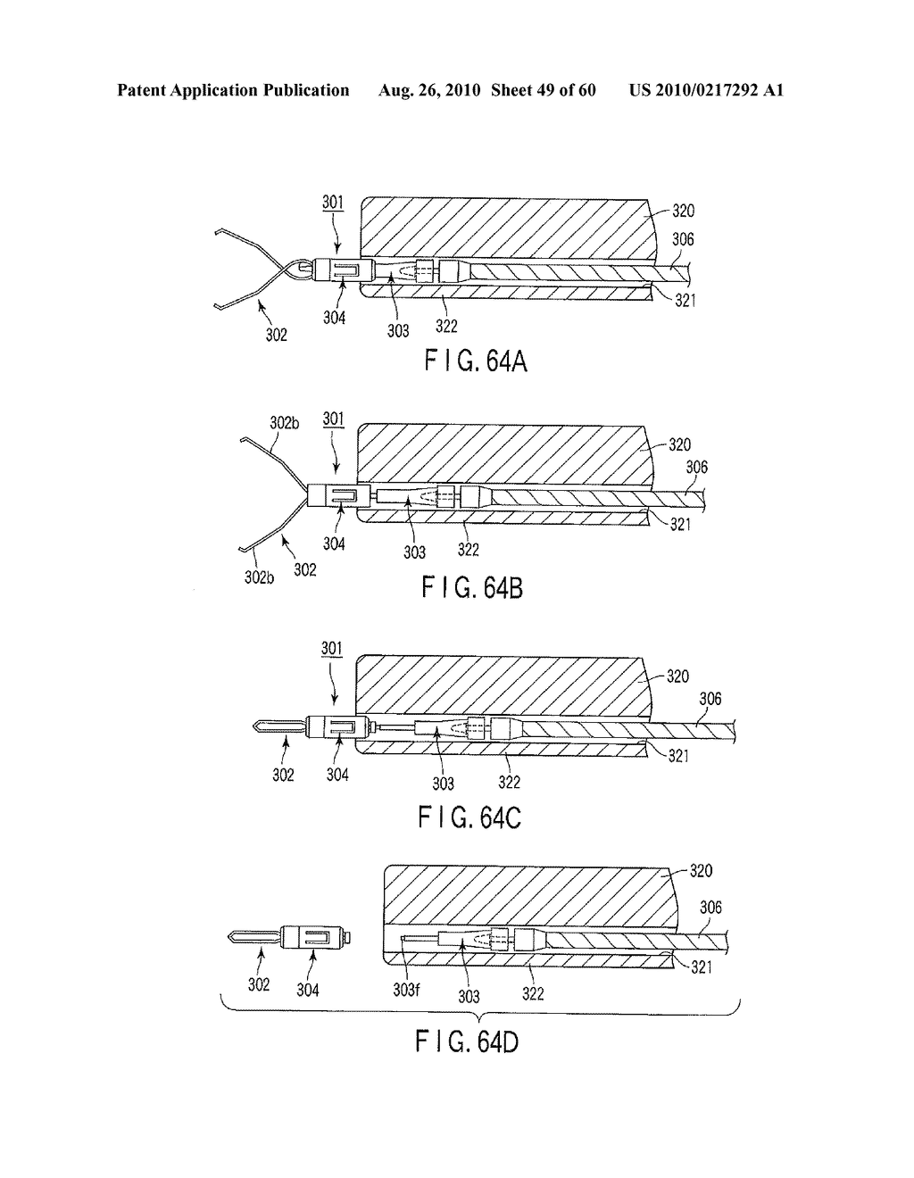 LIVING TISSUE LIGATION DEVICE - diagram, schematic, and image 50