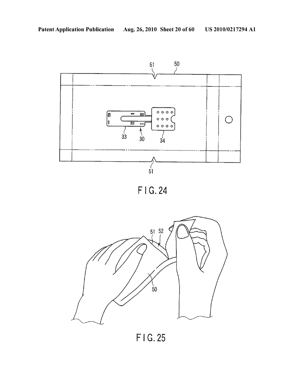 LIVING TISSUE LIGATION DEVICE - diagram, schematic, and image 21