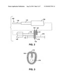 EMBOLIC FILTER DEVICE INDEPENDENT OF TREATMENT DEVICE diagram and image