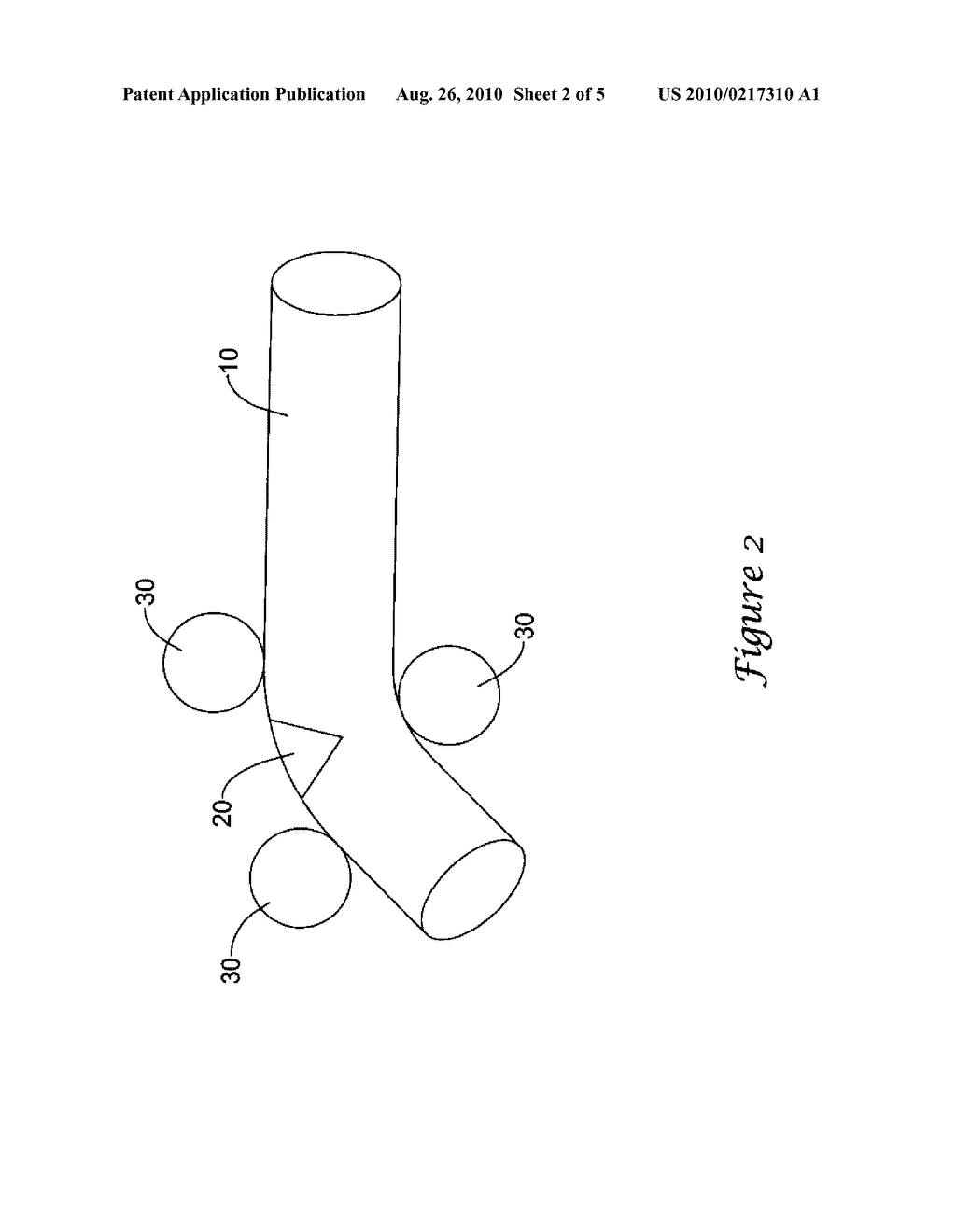 MODIFIED PLUG FOR ARTERIOTOMY CLOSURE - diagram, schematic, and image 03