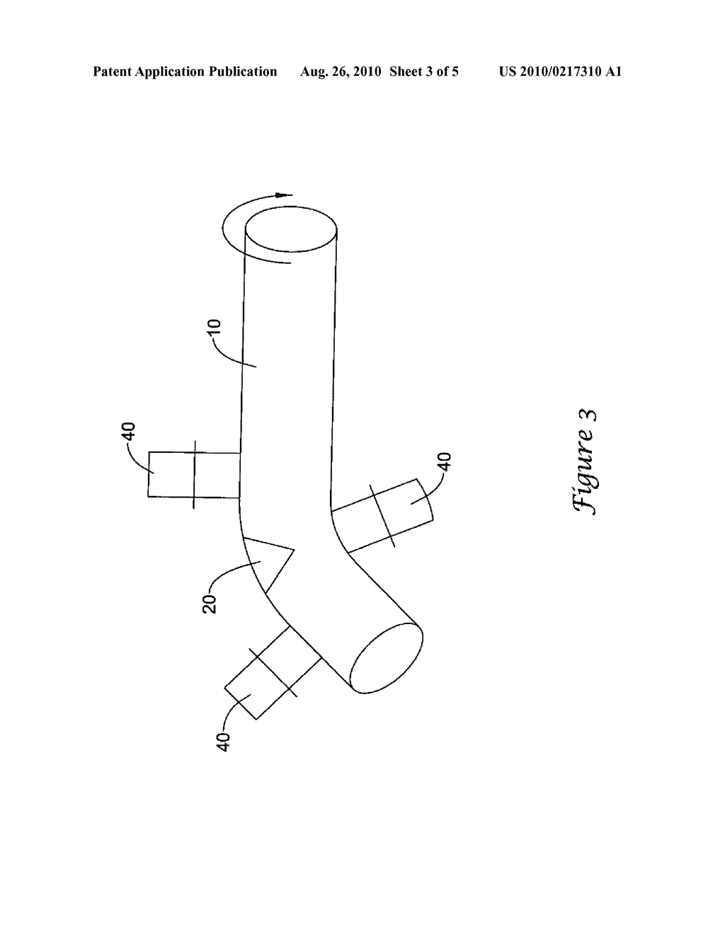 MODIFIED PLUG FOR ARTERIOTOMY CLOSURE - diagram, schematic, and image 04