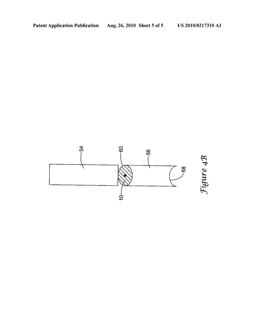 MODIFIED PLUG FOR ARTERIOTOMY CLOSURE - diagram, schematic, and image 06