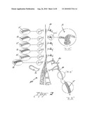 Suture treatment method and kit therefor diagram and image