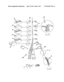 Suture treatment method and kit therefor diagram and image