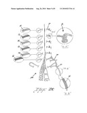 Suture treatment method and kit therefor diagram and image