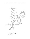 Suture treatment method and kit therefor diagram and image