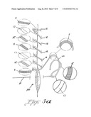 Suture treatment method and kit therefor diagram and image